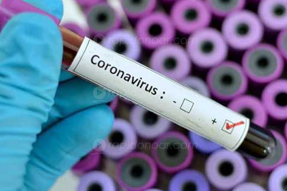 Resultado de imagem para Número de suspeitas de coronavírus no Brasil sobe para 13, sete deles em SP